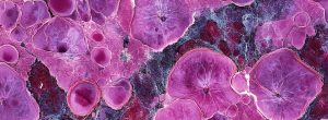 kidney cells