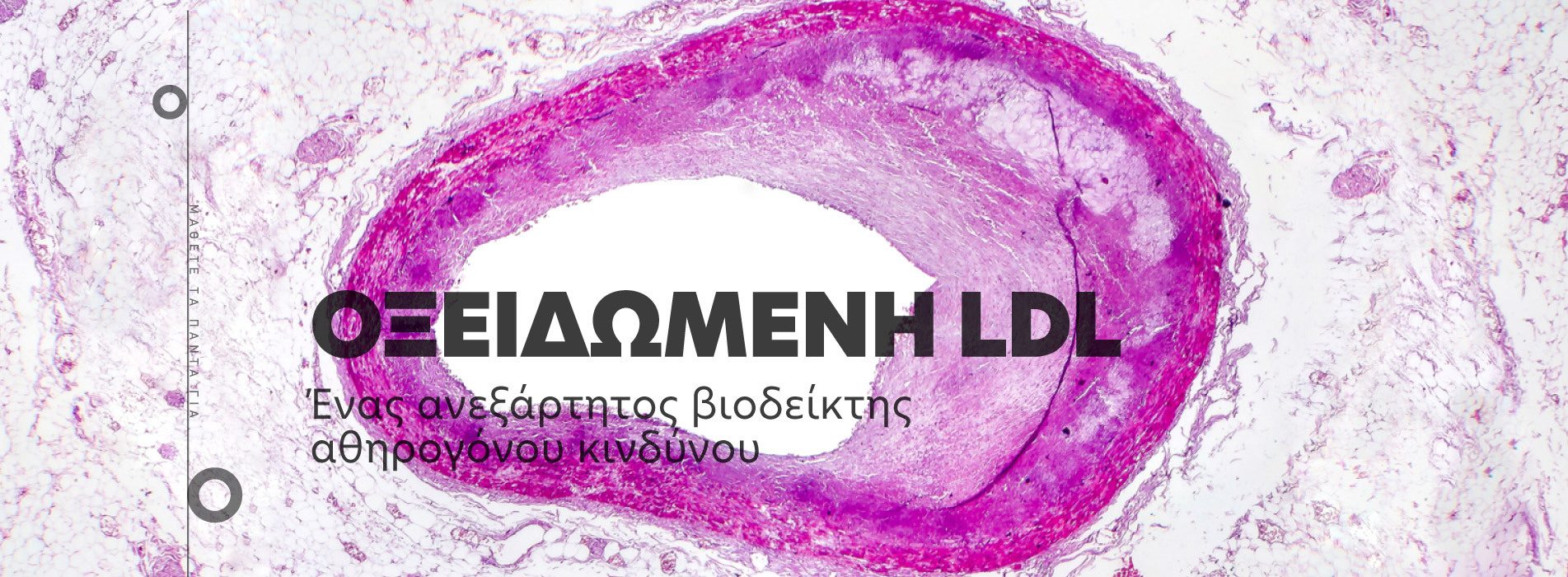 Οξειδωμένη LDL